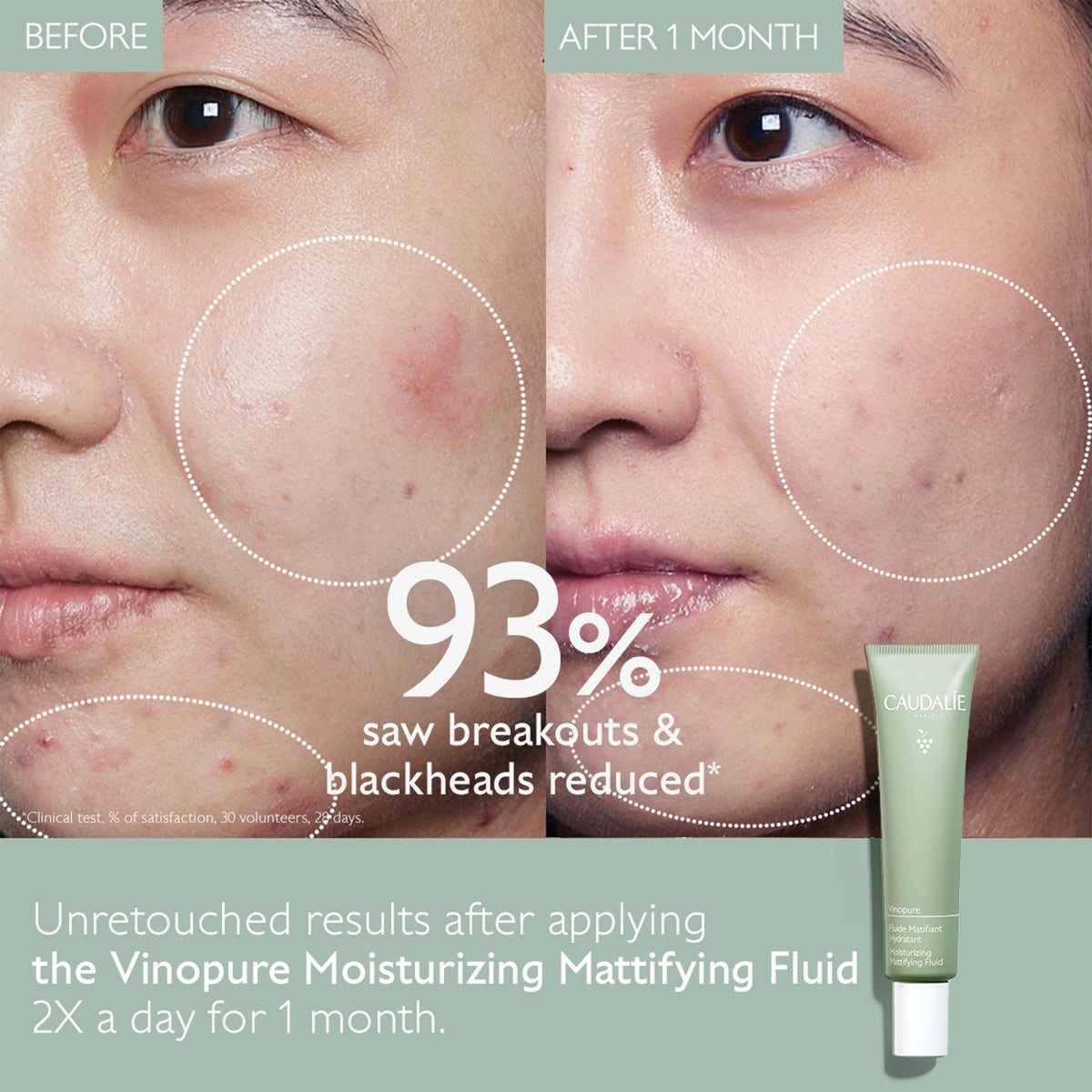 Oil Control Moisturizer 40 mL G5000