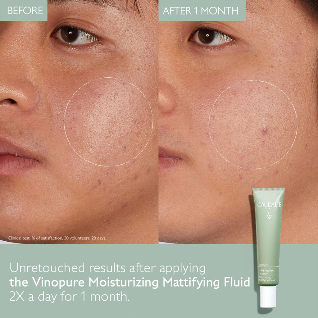 Oil Control Moisturizer 40 mL G5000